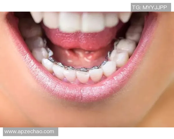 戴牙套的足球明星揭秘谁曾因牙齿问题改变形象成为球场焦点